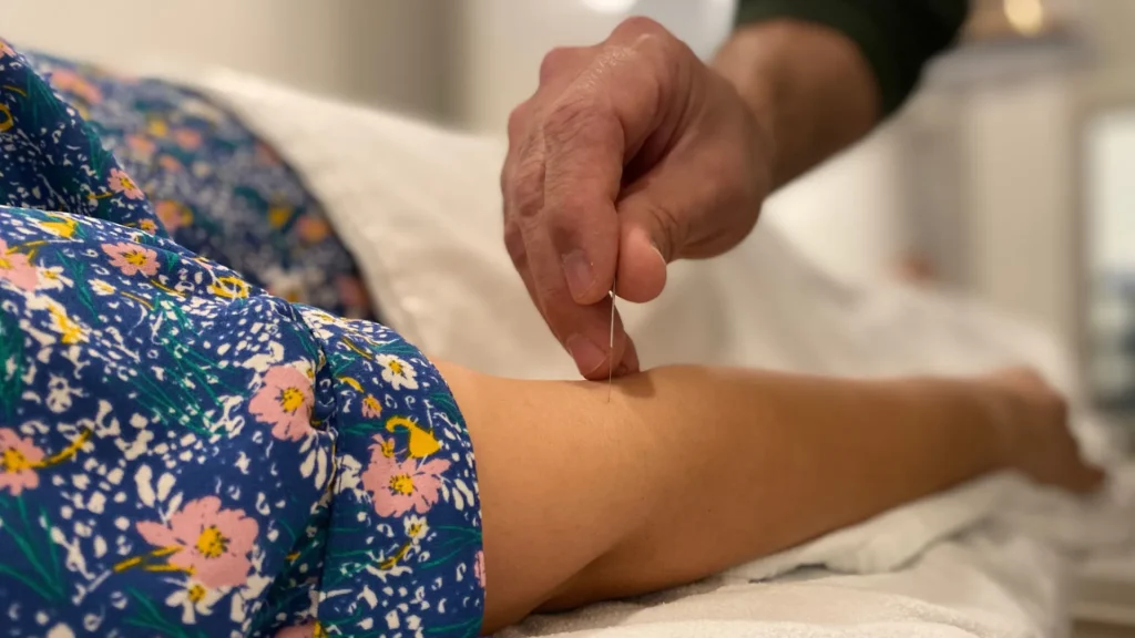 Navigating Your IVF Journey: Could Acupuncture Be Your Trusted Ally?